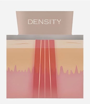 Diagram of monopolar RF traveling vertically into the deep skin layers