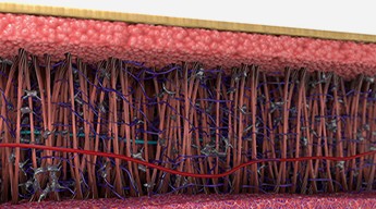 Cross-section of skin densely filled with new collagen