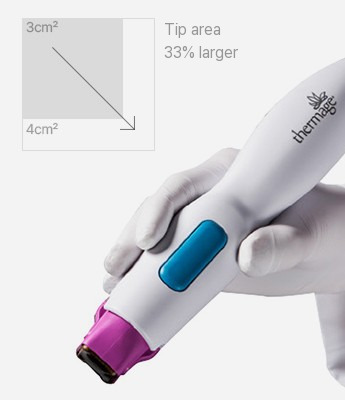 Thermage FLX handpiece: tip area increased 33%, from 3cm² to 4cm²