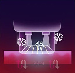 Diagram of collagen remodeling lifting the skin